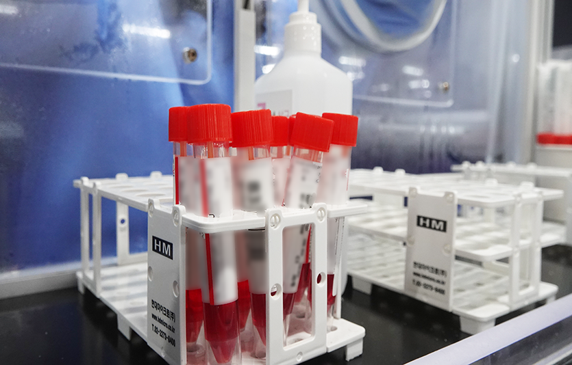 해외 입국자들에게 채취한 PCR 검체 시료. 사진=신광렬 기자