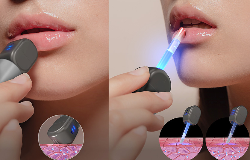 ‘CES 2024’ 혁신상을 수상한 아모레퍼시픽의 립큐어빔. 사진=아모레퍼시픽